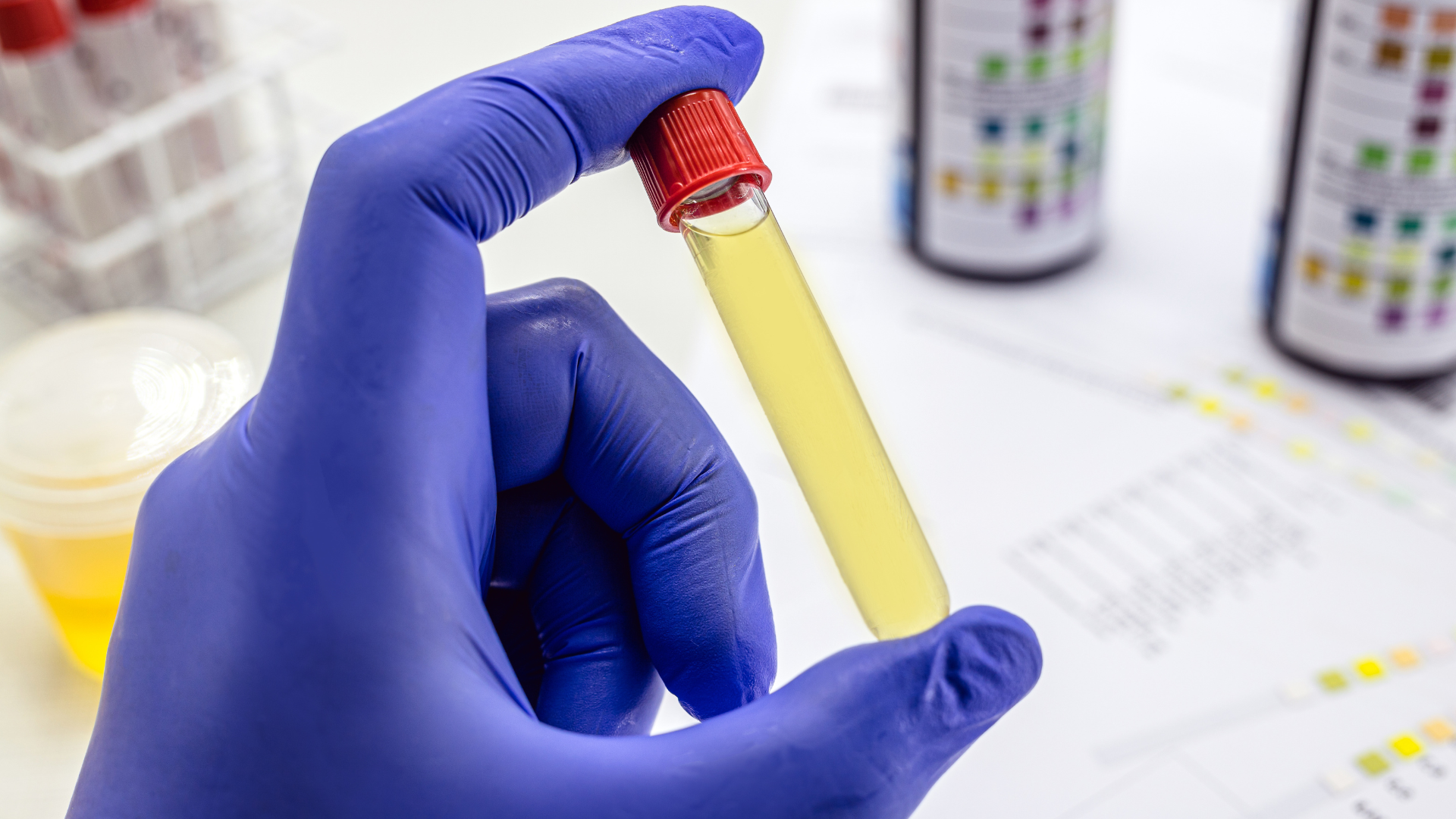 Exame Toxicológico no eSocial